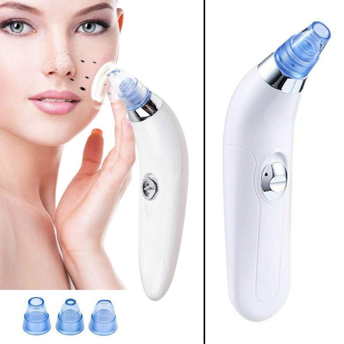 Derma Suction Blackhead Remover | Pore Cleaner Vacuum Tool | Pocket Blackhead & Pimple Remover