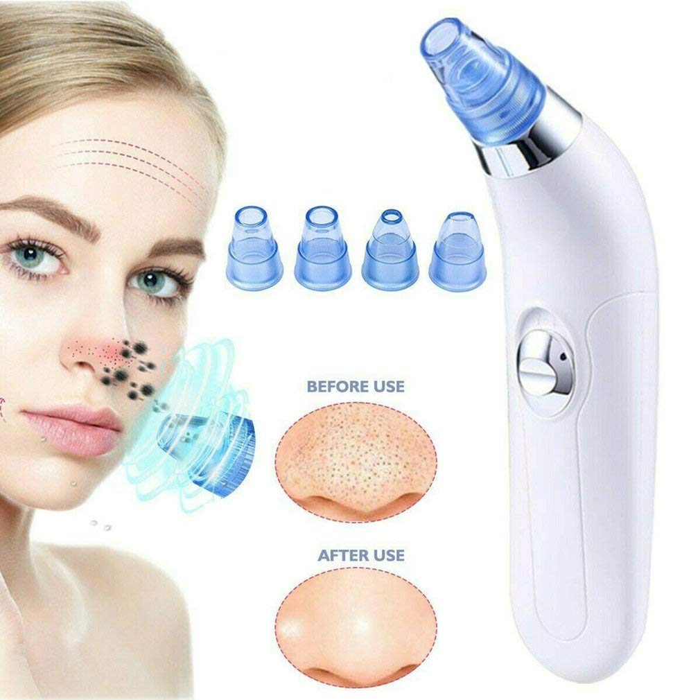 Derma Suction Blackhead Remover | Pore Cleaner Vacuum Tool | Pocket Blackhead & Pimple Remover